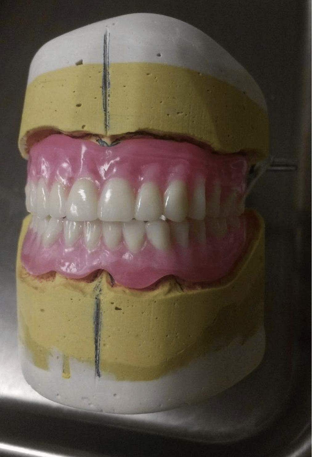 wax tooth arrangement