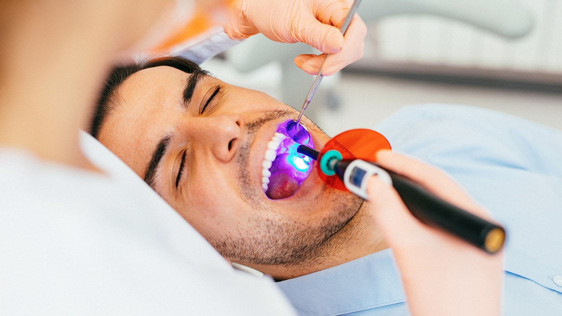 man having Dental Sealants